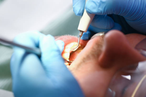 Best Emergency Dental Care for Broken or Chipped Teeth in Nolensville, TN