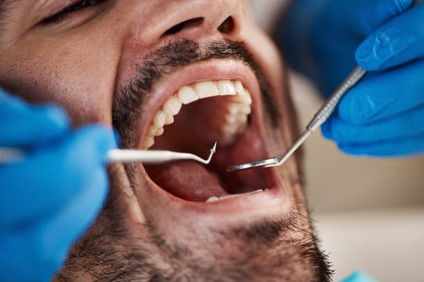 Best Emergency Treatment for Dental Infections or Abscesses in Nolensville, TN